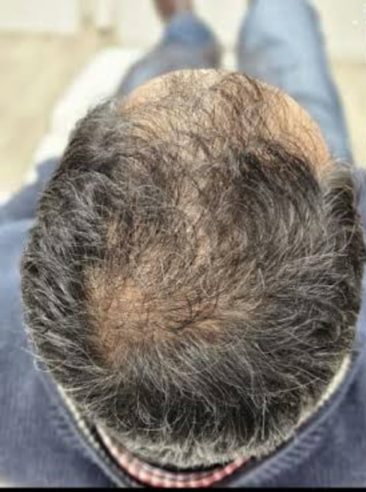Customer hair journey before