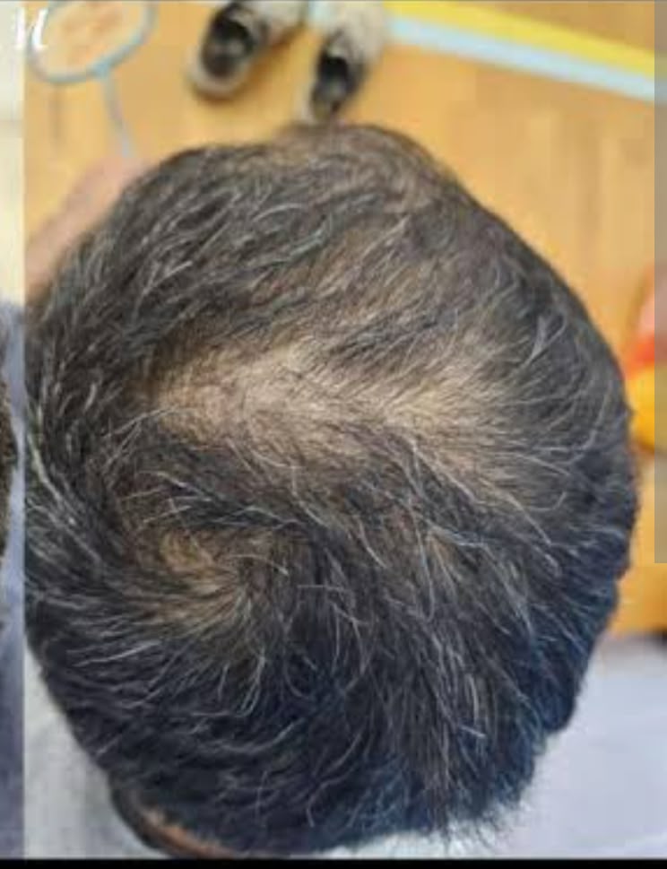 Customer hair journey after