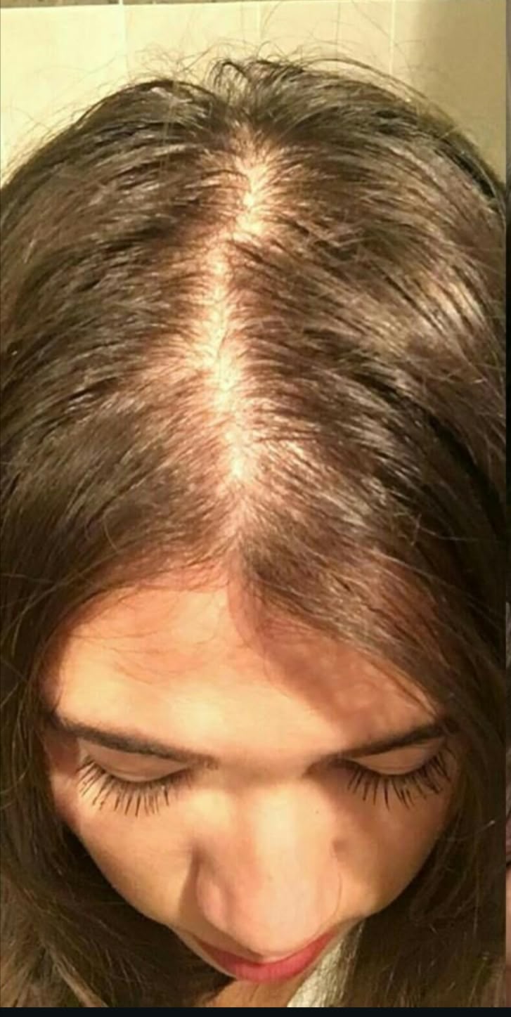 Customer hair journey before