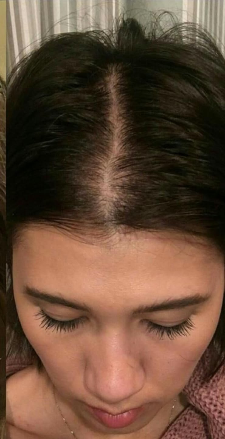 Customer hair journey after