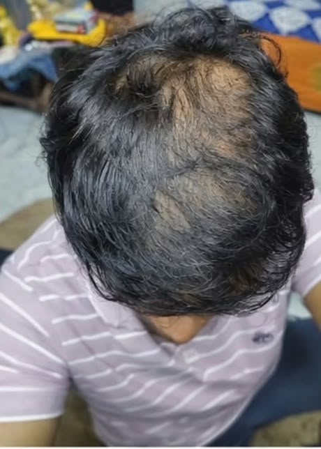 Customer hair journey after
