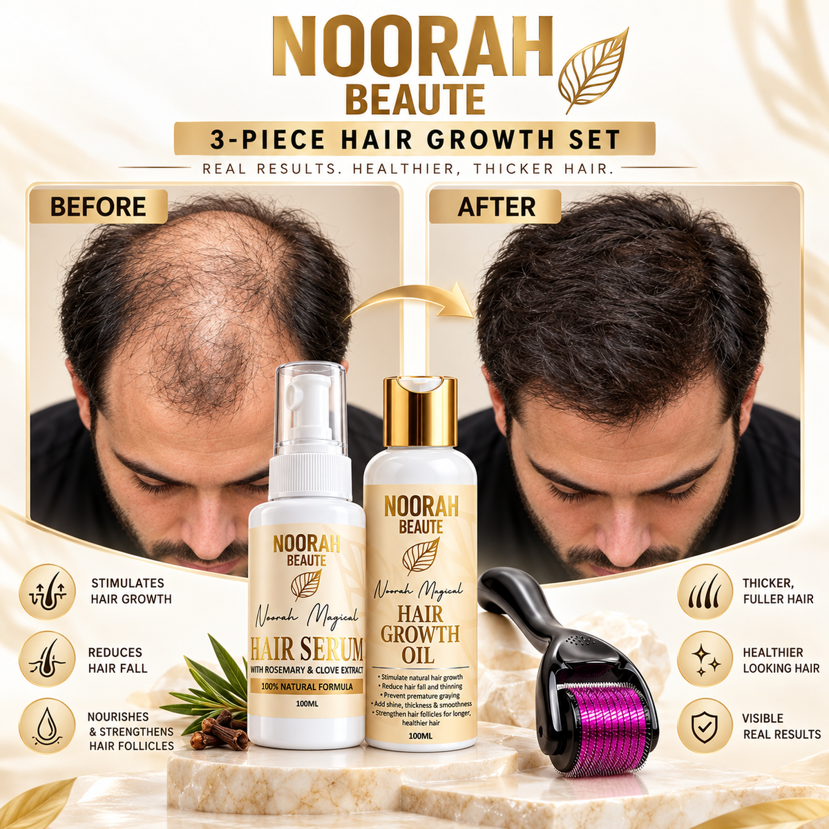 Noorah Beaute 3-Piece EXTREME Hair Growth Set
